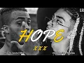 Download Lagu Hope - ( Xxxtentacion X Mc Stan ) Visuals By Hope Recordxx 2k22