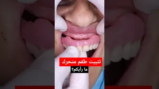 طقم أسنان متحر ك وجبة بدلة كالاسنان الطبيعية 