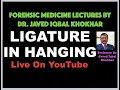 15 LIGATURE MARK IN HANGING-BY DR JAVED IQBAL KHOKHAR