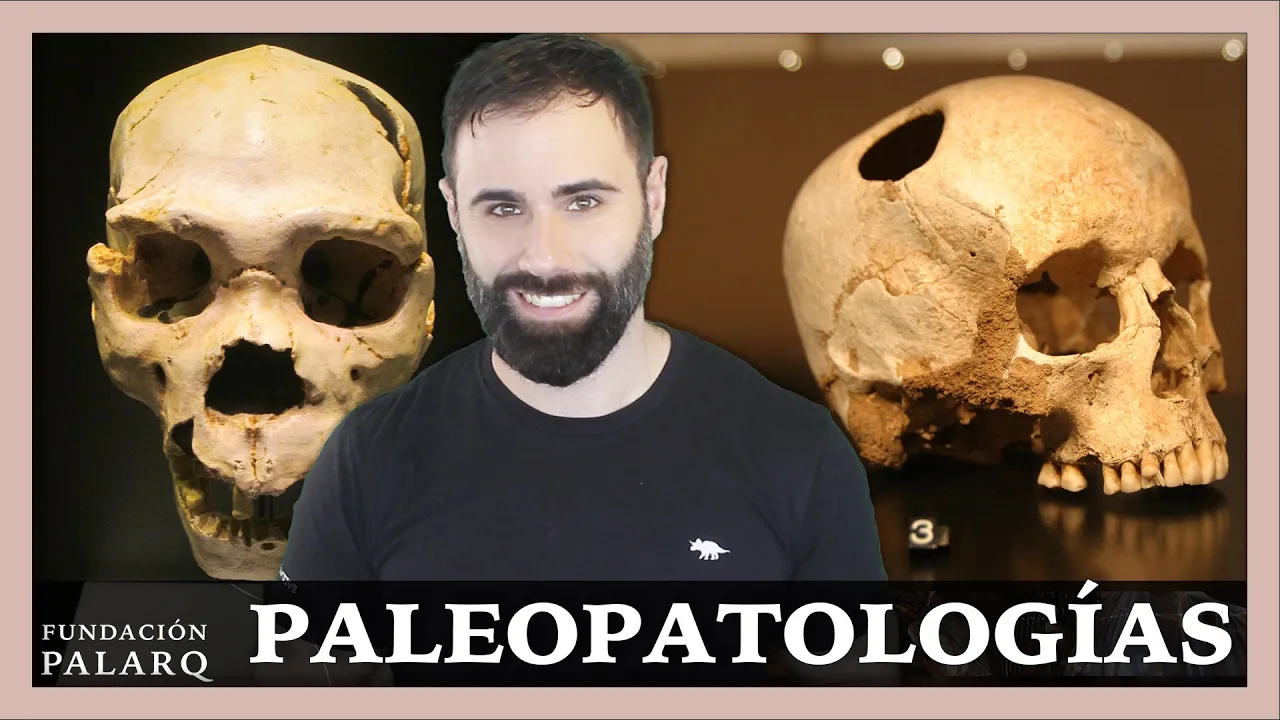 Las PALEOPATOLOGÍAS: Las enfermedades que sufrían los seres vivos del pasado