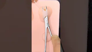 Satisfying Abscess Technique