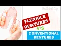 FLEXIBLE DENTURES - PROS AND CONS