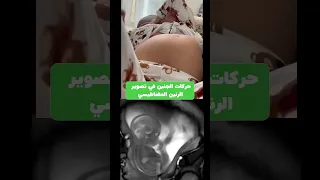 حركة الجنين داخل البطن خلال الحمل لمدة 9 أشهر 