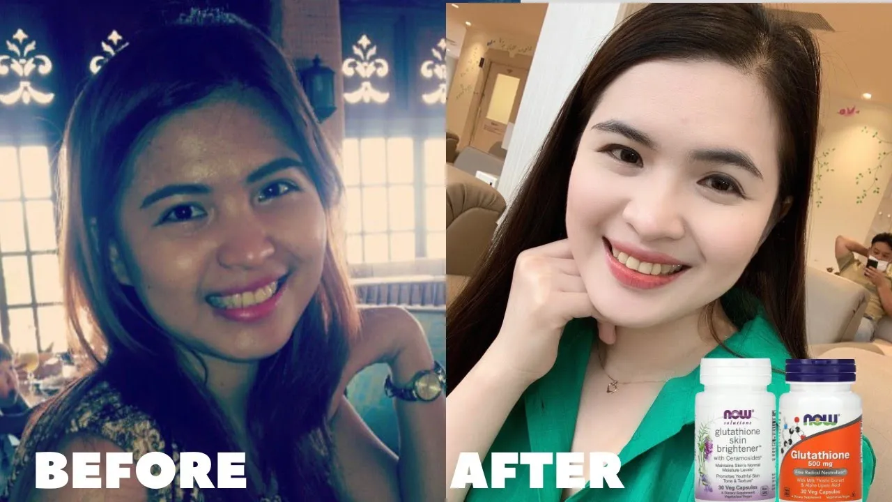 GLUTATHIONE BEFORE AND AFTER: How to whiten skin