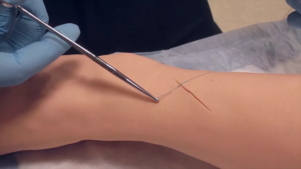 Simple Interrupted Sutures