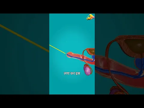 पेशाब की नाली कैसे लगती है? 🤯 3D Animation