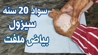 ادهشي زوجك ملعقة خل مع ملعقة قهوة ولن تصدق النتائج مدهشه للغايه ندمت إني ما عرفتها تبييض فوري للعانة 