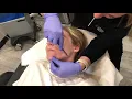 Dermaplaning Near Me in at RevitalyzeMD 865 293-5828