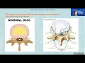 Spine 101 Tips for a healthy back Free webinar
