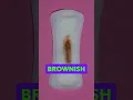 Is Brown Discharge Normal After Your Period? #womenshealth