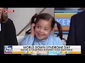 Rachel Campos-Duffy brings daughter to Fox Friends on Down Syndrome Day