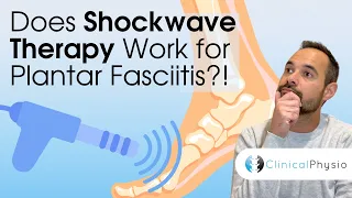 Does Shockwave Therapy Work for Plantar Fasciitis Expert Physio Explains the Research