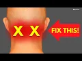Download Lagu How to Instantly Relieve Neck Pain at the BASE OF THE SKULL