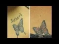 Tattoo Removal Cost Springfield MO