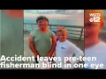 Young fisherman hopes to regain eyesight after terrifying accident
