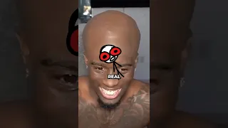 Forehead Tier List