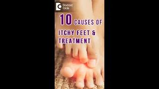 10 Causes of ITCHY FEET how to get relief - Dr Urmila Nischal Doctors Circle