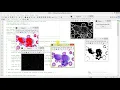 Leukemia Cancer Detection Using Matlab