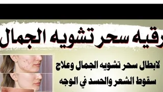 رقية العقد على الوجه رقية استرجاع الجمال ابطال سحر تشويه الجمال والحسد الوجهstrong Roqyah For Magic 