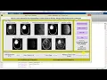 Matlab Code for Brain Tumor Detection and Classification Using Watershed Technique