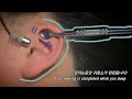 Download Lagu ASMR) Real Series_  잠자는동안 귀청소가 완료됩니다!_ Ear cleaning is completed while you sleep_ 寝ている間に耳掃除が完了します