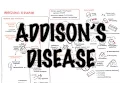 Addison s Disease - Overview clinical features pathophysiology investigations treatment