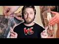 Second Skin Vs Traditional Healing Which Is Better