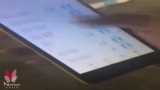 نوران وليد دندنها