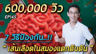 การออกกำลังกายอย่างไรจึงจะช่วยป้องกันโรคหลอดเลือดสมองได้ดี?