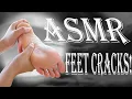 Download Lagu ASMR FEET CRACKS - LOUD CRACKS