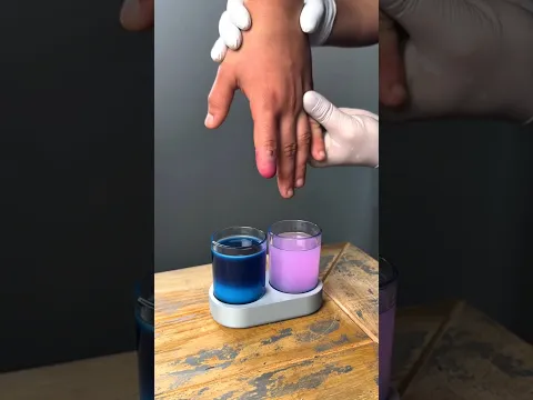 Dad Built a Genius Gadget to Help Mom’s Injured Finger! 😱❤️! #shorts