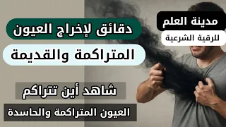 رقية لإخراج عيون متراكمة حاسدة بشكل سريع إذا علم المصاب أين تتراكم العيون لاستطاع إخراجها بسهولة 