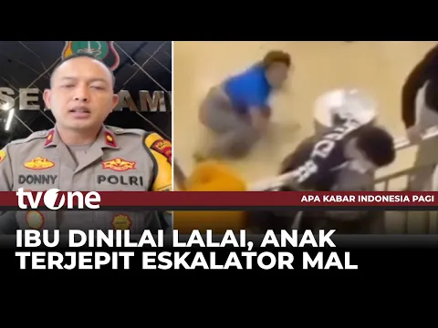 Terjepit Eskalator Mal, Balita Dua Tahun Patah Tulang
