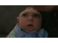 Miracle Baby Born Without Most of His Brain Defying Odds ABC News