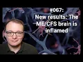 067 - New results The brain is inflamed