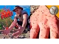 FIRE ANT ATTACK