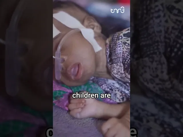 ⁣Somalians suffering from worst drought in 40 years