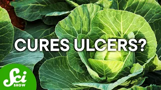 The Cure for Ulcers Is ... Cabbage