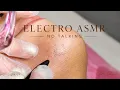 Precision Chin Hair Removal Real Electrolysis Sounds Session 09