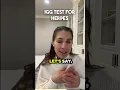 Igg Test for Herpes