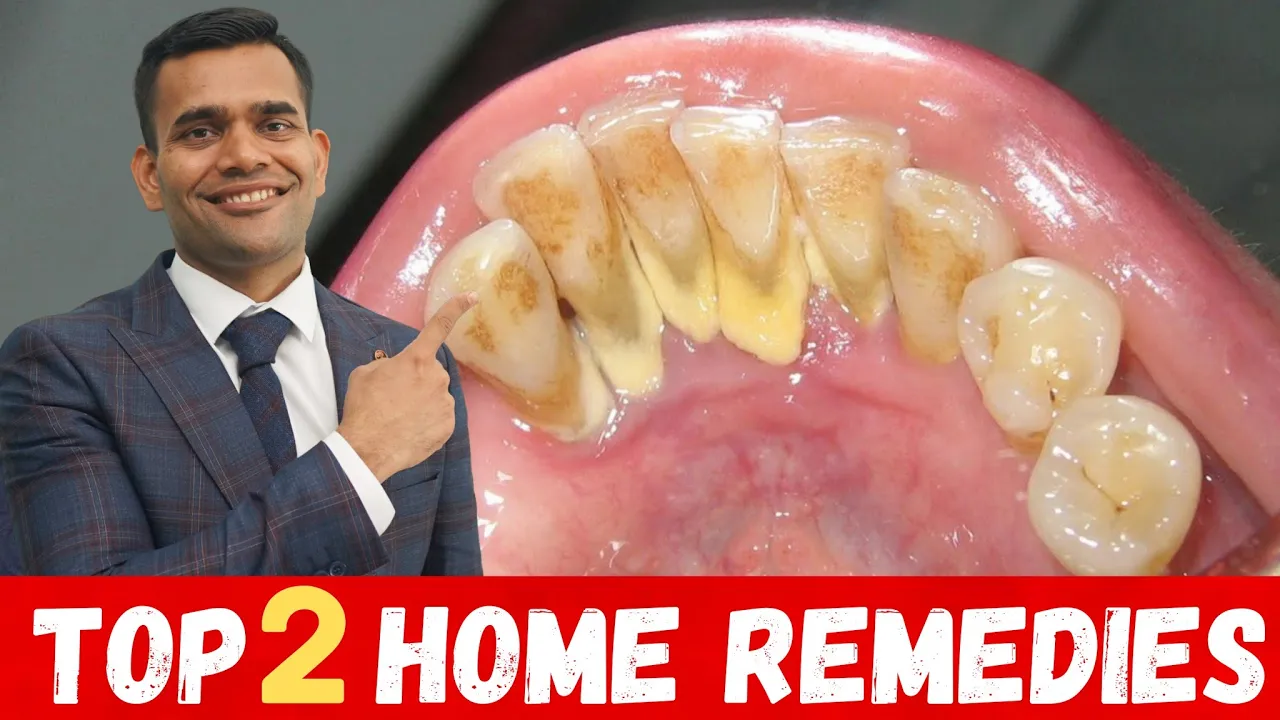 Outline Video Top 2 Remedies To Remove Dental Plaque | Remove Dental Plaque and keep Oral Hygiene Healthy At Home
