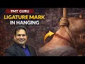 Ligature Mark in Hanging FMT GURU