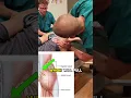 Relief from Herniated Disc Pain? Watch This Technique!