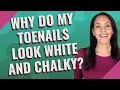 Why do my toenails look white and chalky