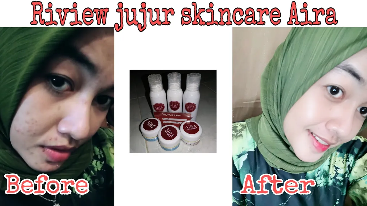 Assalamualaikum guys  ☺️ Di video HARGA SKINCARE AIRA - AIRA CLINIC SKINCARE PEKANBARU kali ini aku . 