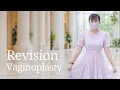 JingJing s Revision Vaginoplasty Journey from Nanjing China Colon Vaginoplasty in Bangkok