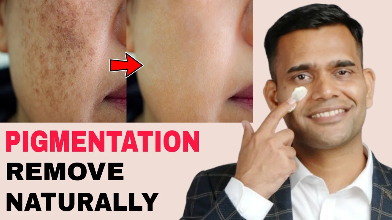 Outline Video Get Rid Of Pigmentation, Darkspots | Remove Pigmentation in Just 2 Steps