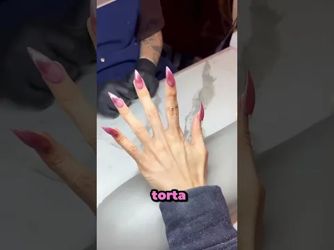 O Motivo Real Da Unha Que Parecia Torta 😂