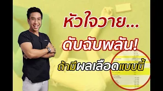 อะไรคือสาเหตุที่ทำให้เกิดหัวใจวายตายฉับพลันโดยไม่ทันตั้งตัว