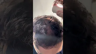 مو سحر بس النتيجة سحرية شعر كثيف وطبيعي في 5 دقائق فقط جربه بنفسك 